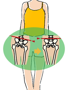 骨盤の歪み